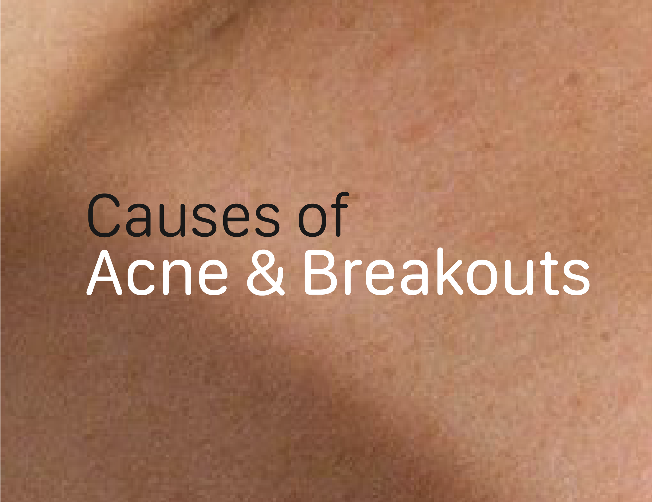 Unveiling Acnes Hidden Triggers